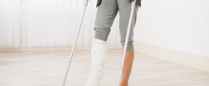 How Do You Make a Claim for a Broken Bone? How Do You Make a Claim for a Broken Bone?